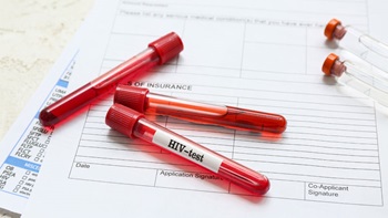 provette test AIDS